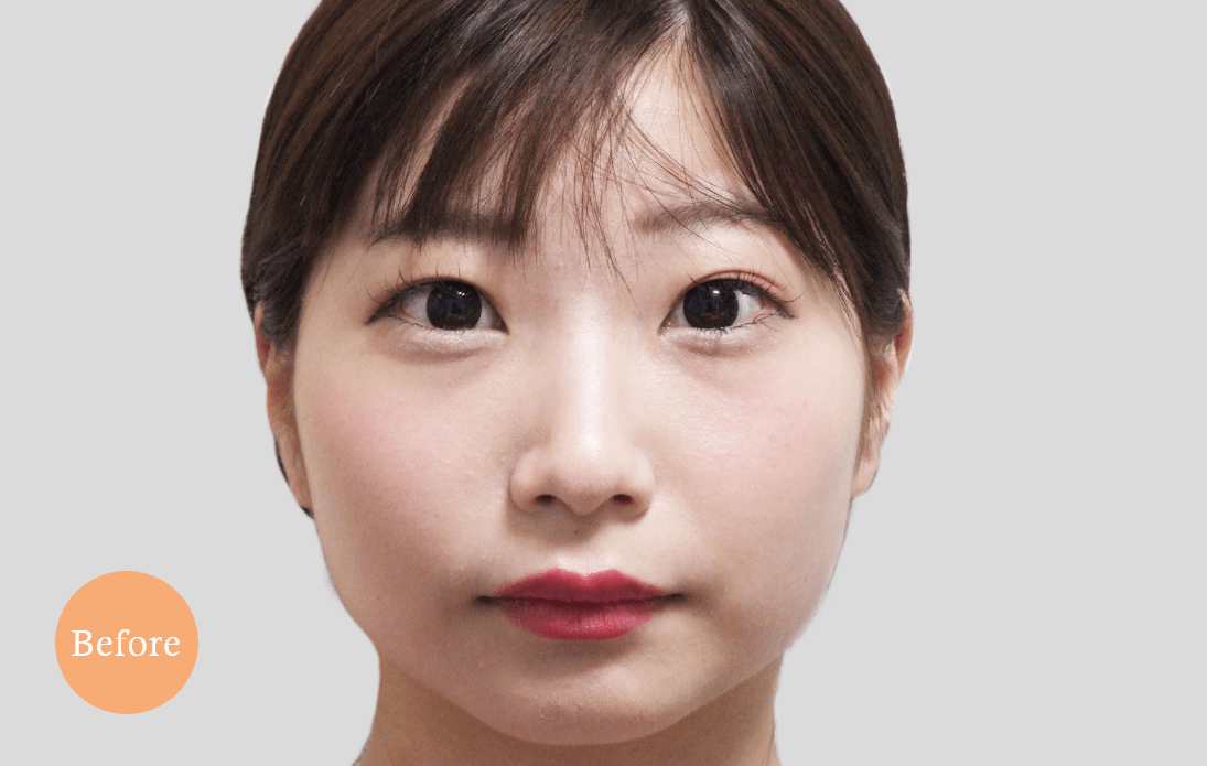 before・after