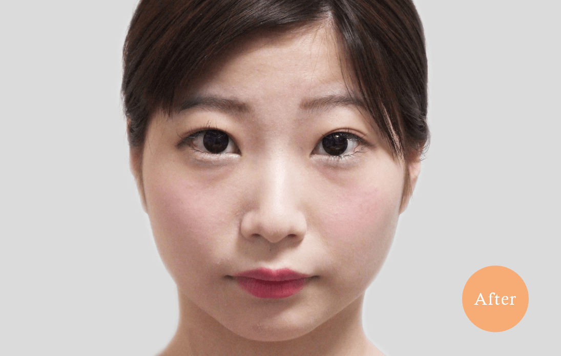before・after