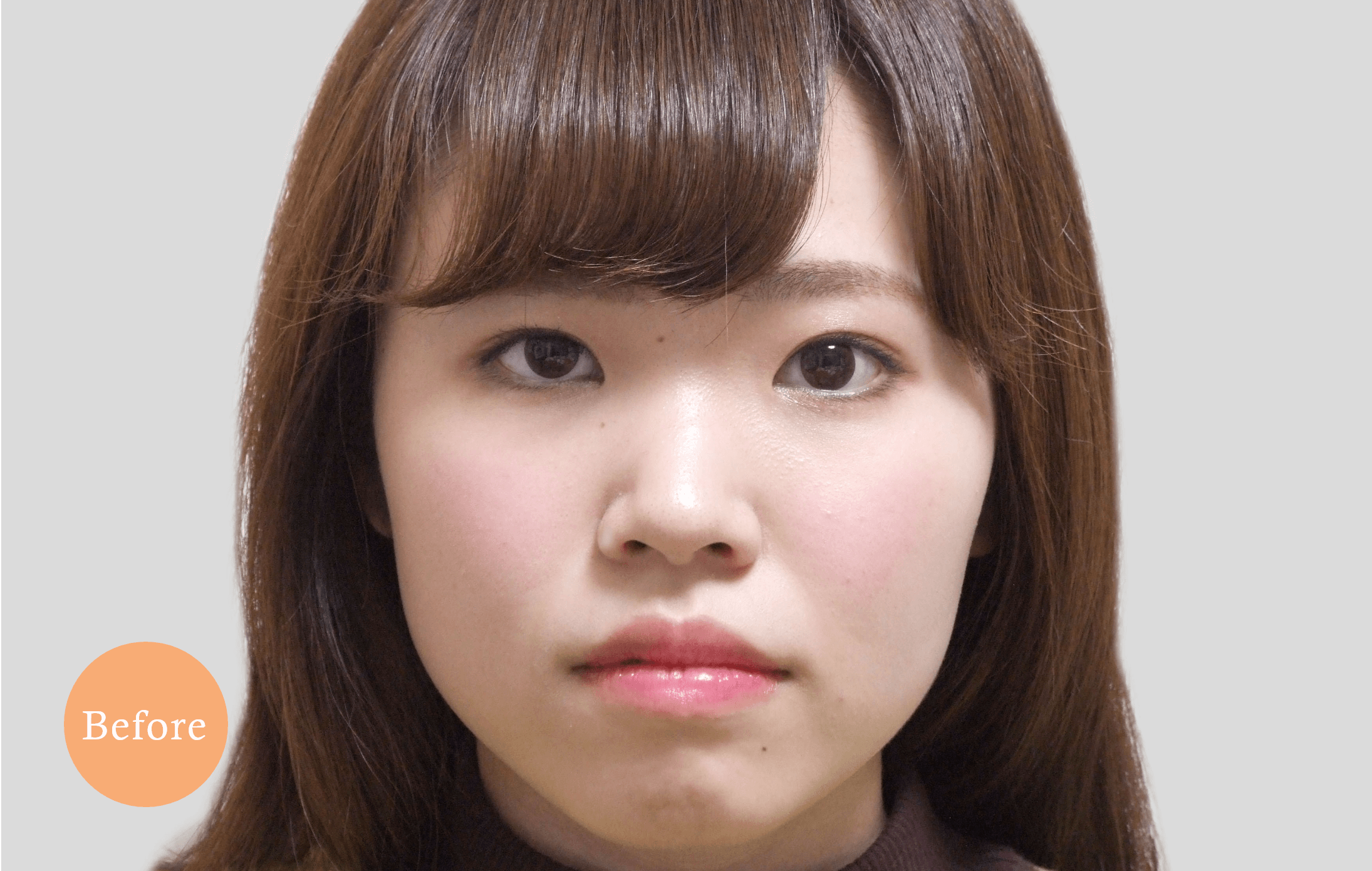 before・after