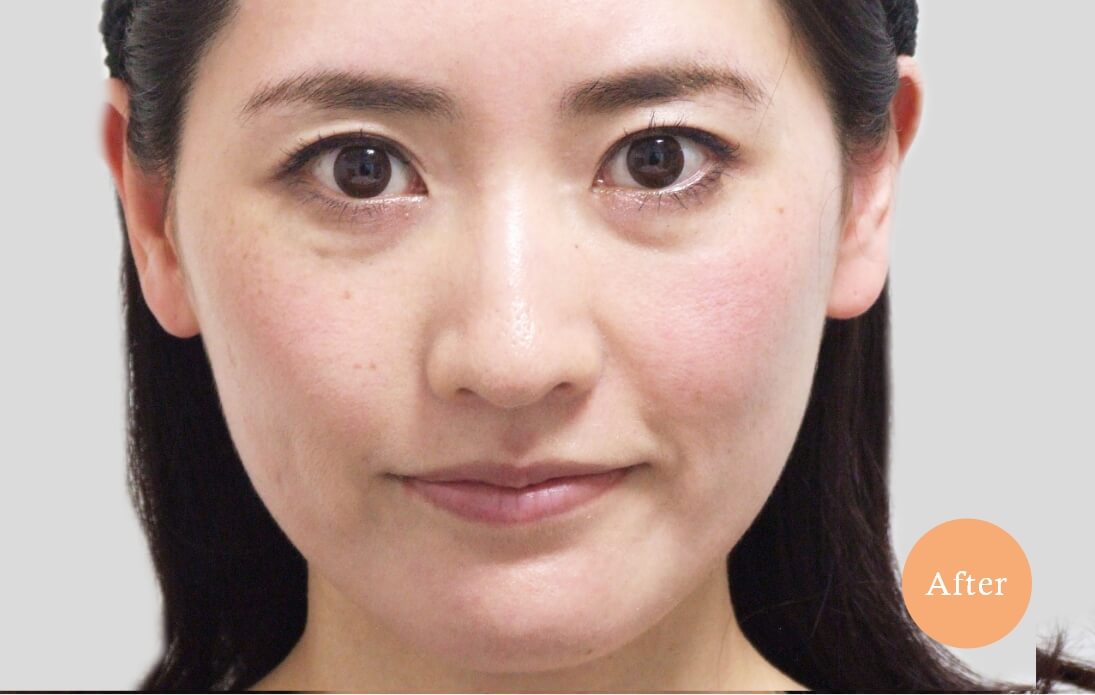 before・after
