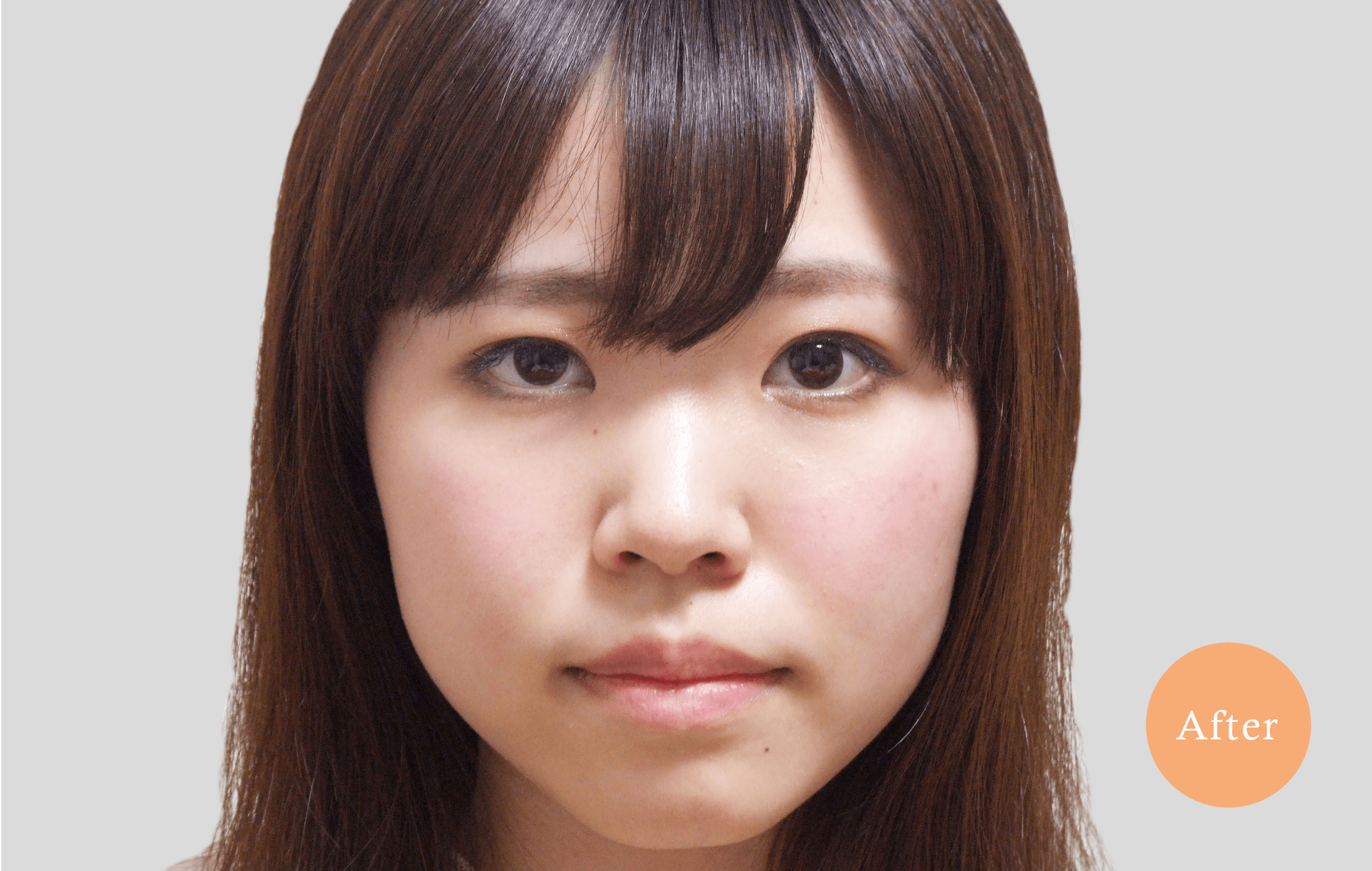 before・after