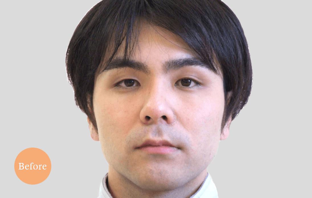 before・after