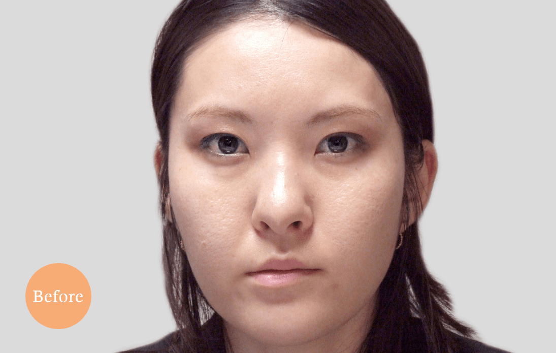 before・after