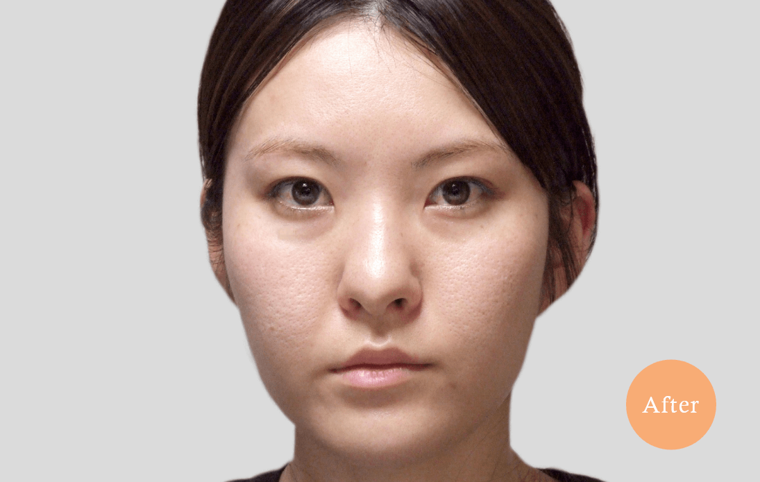 before・after